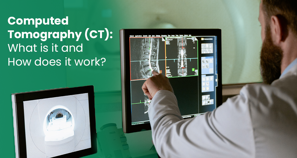 Computed Topography (CT) Scan