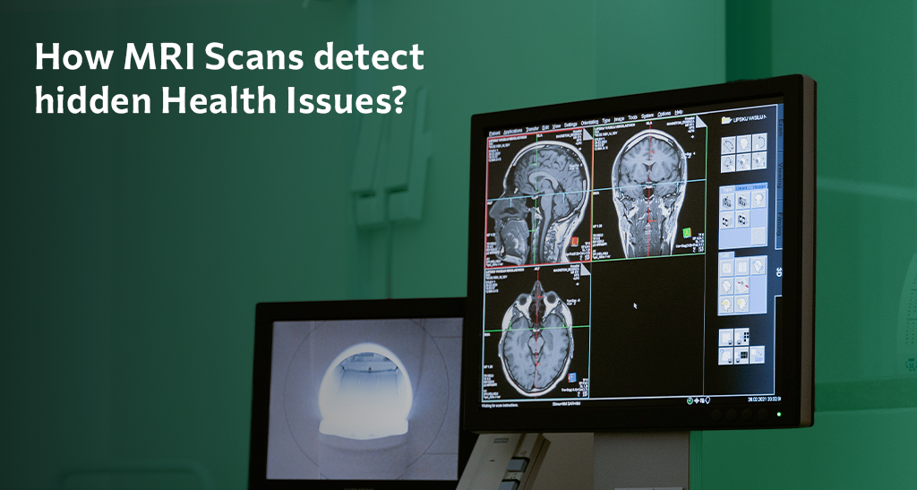 How MRI scans help detect hidden health issues