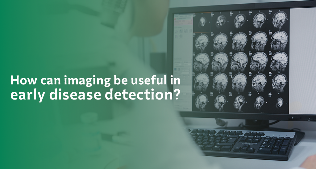 Imaging useful in early detection
