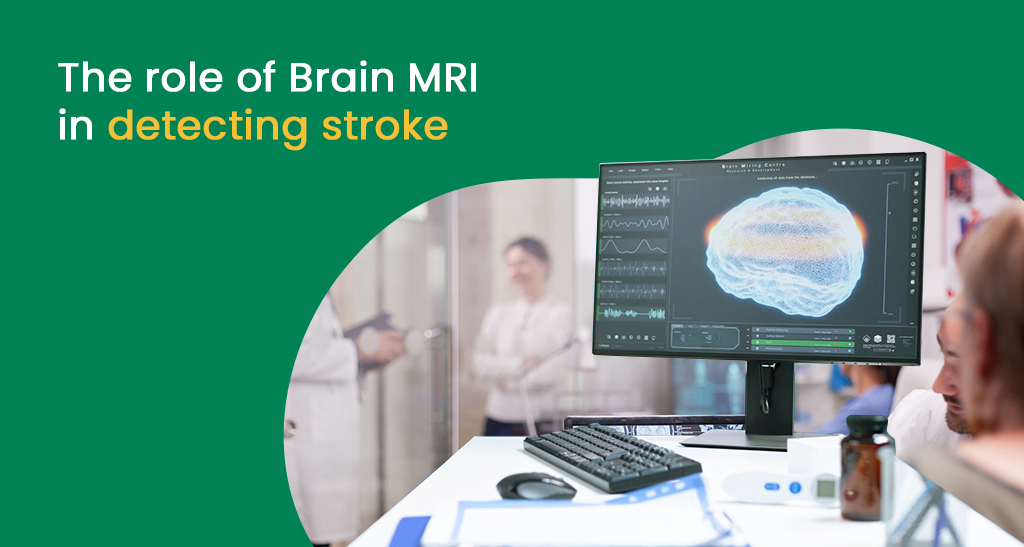Brain MRI role in stroke